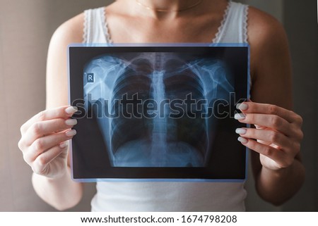 Lung radiography concept. Virus and bacteria infected the Human lungs. Patient with Lung Cancer or Pneumonia.