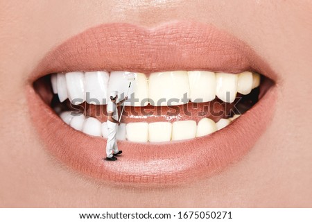 Laughing woman mouth with great teeth over white background. Whitening concept. Dentistry. Royalty-Free Stock Photo #1675050271