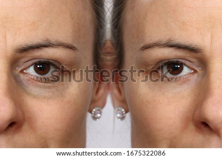 Comparison between before and after showing the results of skin treatment