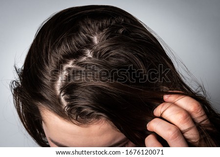 Young woman with dirty greasy hair on gray background.  Royalty-Free Stock Photo #1676120071