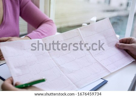 Closeup photo of ECG cardiogram pulse graph on a paper.