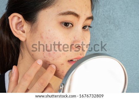 Portrait of Asian woman worry about her face when she saw the problem of acne inflammation and scar by the mini mirror. Conceptual shot of Acne  Problem Skin on female face. Royalty-Free Stock Photo #1676732809