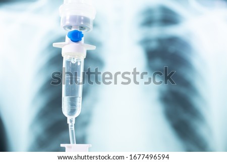 Saline drip medical, IV Drip Solution, Intravenous Treatment for Hospital Patients, coronavirus or covid-19 concept, Lung X-ray Film Destruction Background. soft focus. Royalty-Free Stock Photo #1677496594