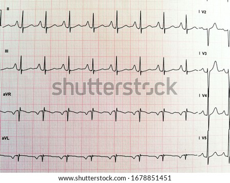 heart rate x-ray on a strap-red background,heart line curves,medical examination cardiogram