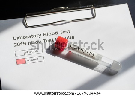 Testing for nCovid-19 Corona Virus 2019-2020