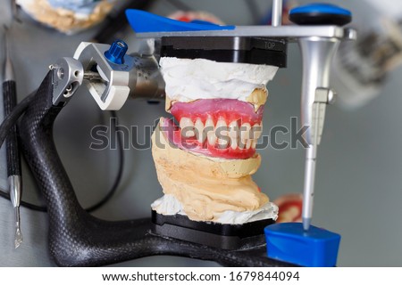 wax up future prostheses in the articulator