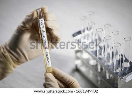 Conceptual photograph of a doctor's hands holding and looking at a test tube while with positive samples for the presence of coronavirus (COVID-19).