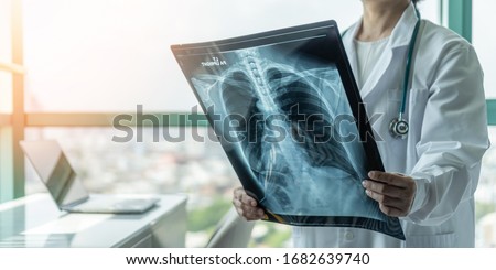 Doctor diagnosing patient’s health on asthma, lung disease, COVID-19, coronavirus or bone cancer illness with radiological chest x-ray film for medical healthcare hospital service Royalty-Free Stock Photo #1682639740
