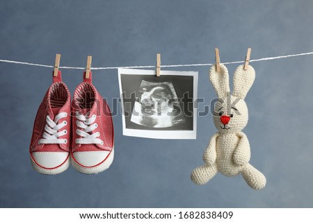 Pair of child's booties, ultrasound photo and toy bunny hanging on laundry line against dark background