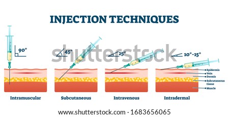 Injection techniques vector illustration. Labeled educational medical procedure examples scheme. Various methods of needle jab in skin. Intramuscular, subcutaneous, intravenous and intradermal process Royalty-Free Stock Photo #1683656065