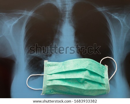 Lungs on X-ray film and medical mask, health care roentgen background, pneumonia prevention concept