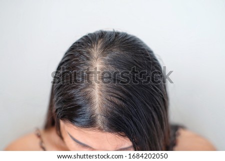 Woman with thin hair problem.