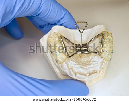Dentist setting in fingers patient teeth model with Hyrax Expander braces known as rapid palatal expander Royalty-Free Stock Photo #1686456892