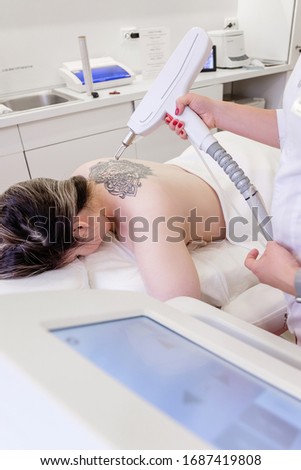 Top view hand of a beautician holds a laser device over a tattooed back of a girl to remove an unwanted tattoo. Concept of erasing tattoos as expensive procedure in beauty parlor modern vedical clinic Royalty-Free Stock Photo #1687419808