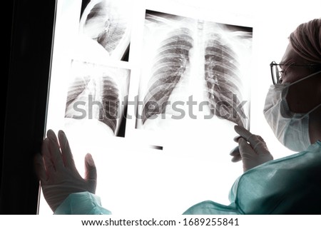Young beautiful woman doctor in a blue dressing gown with glasses and medical gloves holds an x-ray picture of the lungs in his hands and carefully examines the picture against a white light backgroun
