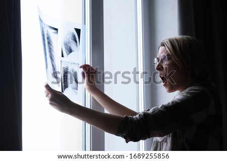 A young woman holds an X-ray picture of the lungs in her hands and looks with surprise the picture against a white light, and empty place for text