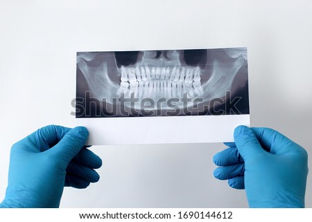 dentist holds a photo of teeth in his hands