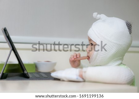 Little asian girl was lying ill in bed at the hospital. Asian baby girl are sick with Atopic dermatitis, She was wrapped with a bandage on the head neck and arms.
