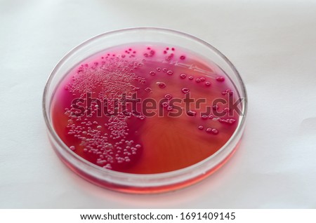 ESCHERICHIA-COLI-ON-MACCONKEY-AGAR Stock Photos and Images - Avopix.com