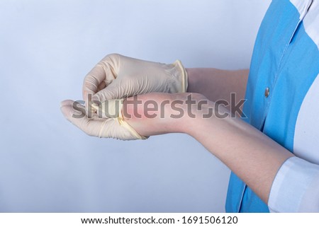 a nurse in uniform removes rubber medical disposable gloves from her hands. Redness is visible on the skin of the hand, a sign of allergy. protection against coronavirus, bodily contact Royalty-Free Stock Photo #1691506120