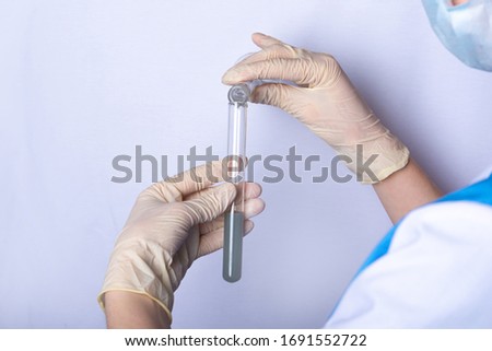 a nurse in uniform pours a gray reagent from a flask into a beaker. hands in rubber gloves. personal protective equipment scientific experiments. chemical stuff Royalty-Free Stock Photo #1691552722