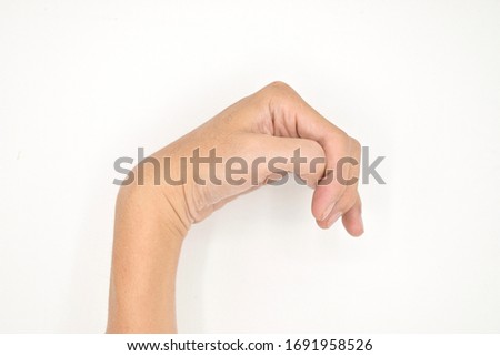Cerebral palsy hand in Southeast Asian, Myanmar young male patient. Typically seen in hemiplegia and quadriplegia. Wrist joint flexion with ulnar deviation. Isolated on white background. Royalty-Free Stock Photo #1691958526