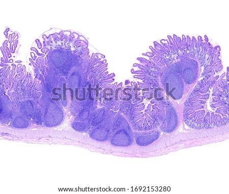Very low magnification micrograph of a distal ileum showings a large aggregate of lymphoid follicles or Peyer’s patch. Royalty-Free Stock Photo #1692153280