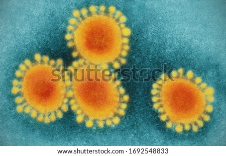 Virus under microscope close up, COVID 19 Royalty-Free Stock Photo #1692548833