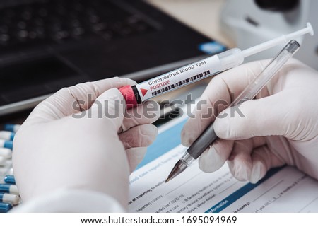 Doctor filling form after coronavirus test. Analysis of test tube with a sample. Tube of biological sample contaminated by Coronavirus in hand wearing a silicone glove. Positive results. Medical exam. Royalty-Free Stock Photo #1695094969