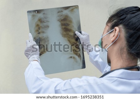 Doctor hands wear rubber gloves and See lung x-ray results, Fight in disaster covid19.
