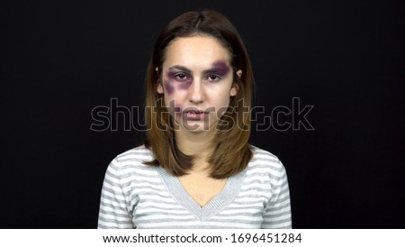 Young woman with bruises on her face. Quarrel in a young family. Domestic violence. On a black background. Royalty-Free Stock Photo #1696451284
