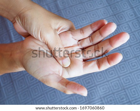 Woman suffering with hand pain and palms, beriberi symptom on hand nerves or inflammation of the muscles from work.