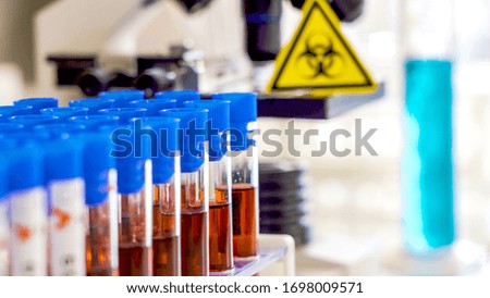 Three positive samples of covid-19 or coronavirus inside the laboratory with the hazard sign on the side
