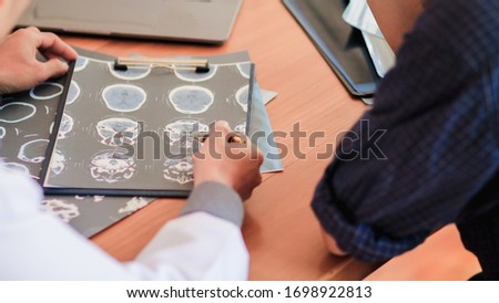 Blurred image,The doctor is diagnosing the tumor picture or cancer from the x-ray film of the patient's brain in order to plan treatment with tumor surgery or cancer from the patient's brain