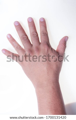 left hand with 6 fingers on a white background