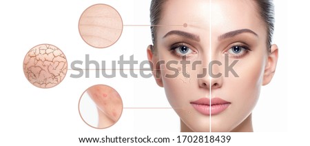 Female face close-up, showing skin problems. Dry skin, acne, wrinkles and other imperfections. Rejuvenation, hydration and skin treatment Royalty-Free Stock Photo #1702818439