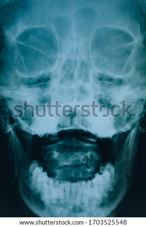 X-ray of the head. Real x-ray picture of a skull. At the doctor’s appointment, hospital.