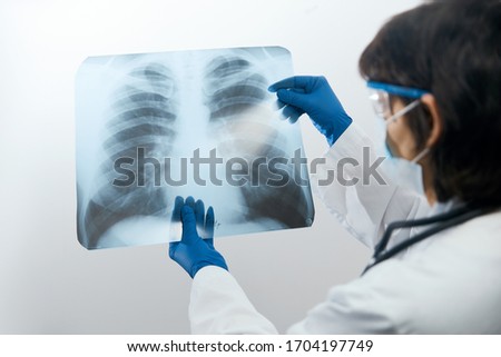 Medical doctor looking through x-ray picture of lungs for  viral pneumonia of a Covid-19 patient in the clinic in hospital. Coronavirus concept 