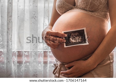 Close up Pregnant woman feeling happy love at home while looking of her Ultrasonography. The young expecting mother holding baby Ultrasound in belly. Maternity prenatal care. New family concept.