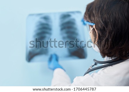 Medical doctor looking through x-ray picture of lungs for  viral pneumonia of a Covid-19 patient in the clinic in hospital. Coronavirus concept 