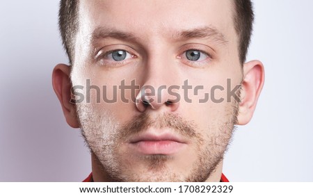 strabismus in a man on grey background  Royalty-Free Stock Photo #1708292329