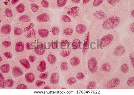 Root tip of Onion and Mitosis cell in the Root tip of Onion under a microscope.
 Royalty-Free Stock Photo #1708497622