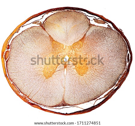 Cross-sectioned spinal cord surrounded by meninges showing, from outside inside, dura mater (thick), subdural space, arachnoid matter (very thin) and subarachnoid space with nerve roots. Silver stain  Royalty-Free Stock Photo #1711274851