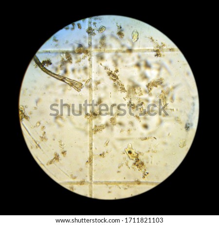 Phytoplankton cells. The picture was taken with an optical microscope by camera. Phytoplankton sample in Russia, Primorsky Krai, Sea of Japan, Vostok Bay, 2009