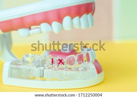 Transparent silicone model of the human jaw with a pin, a practical plastic manual for nurses, doctors and students in dentistry.
