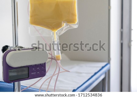 Feeding Pump medical device purple color to supplement nutrition liquid food to tube enteral feeding fluid set bag with clamp hanging on stand. Royalty-Free Stock Photo #1712534836