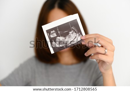 Pregnant Asian woman holding and showing sonogram or ultrasonography picture of her unborn baby