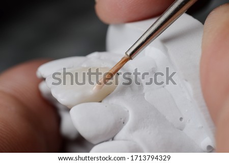 Ceramic powder baking procedure of fabricating porcelain laminated veneer. Ceramic dental veneer to correct tooth color. Royalty-Free Stock Photo #1713794329