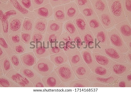 Root tip of Onion and Mitosis cell in the Root tip of Onion under a microscope.
 Royalty-Free Stock Photo #1714168537