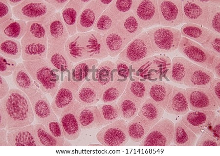 Root tip of Onion and Mitosis cell in the Root tip of Onion under a microscope.
 Royalty-Free Stock Photo #1714168549